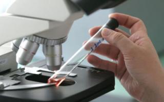 What does the GRA indicator mean in a blood test